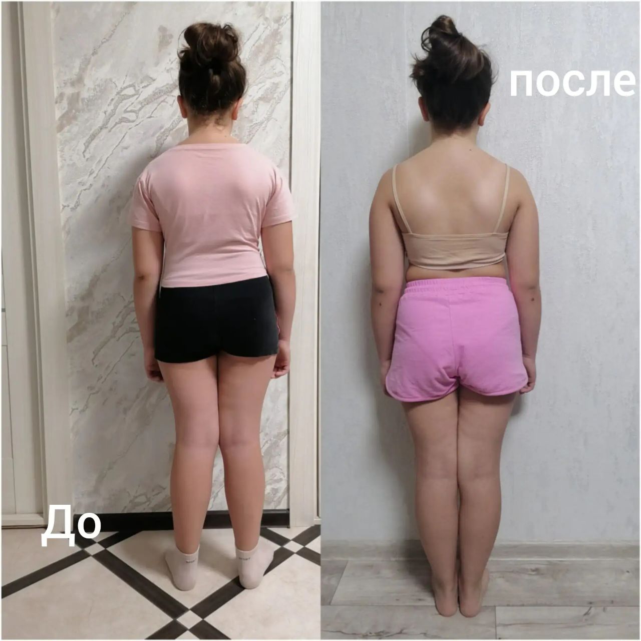 До и после работы с осанкой у ребенка